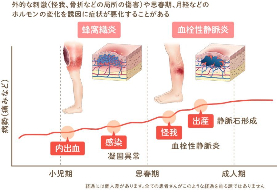 静脈奇形｜難治性血管腫・血管奇形薬物療法研究班情報サイト