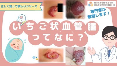 いちご状血管腫（乳児血管腫）の動画を公開しました！ | 患者向け情報